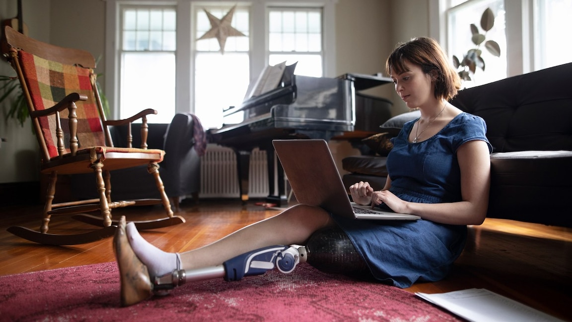 woman with prosthetic leg searching for car insurance on a laptop